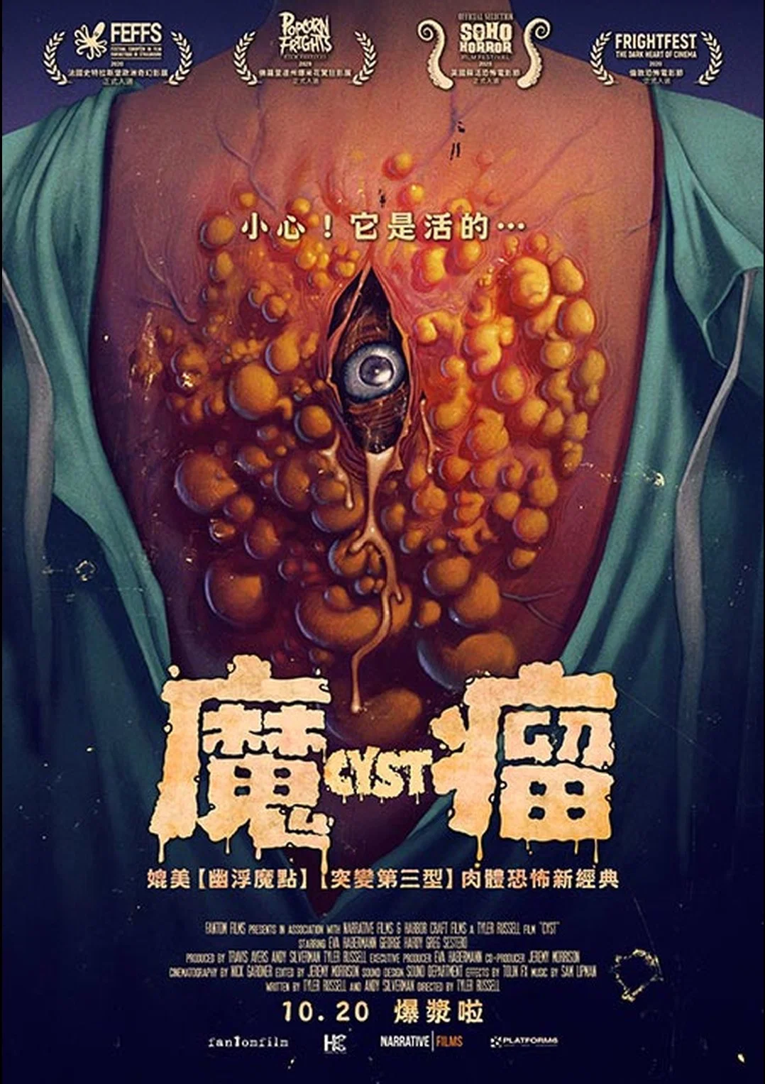 囊肿