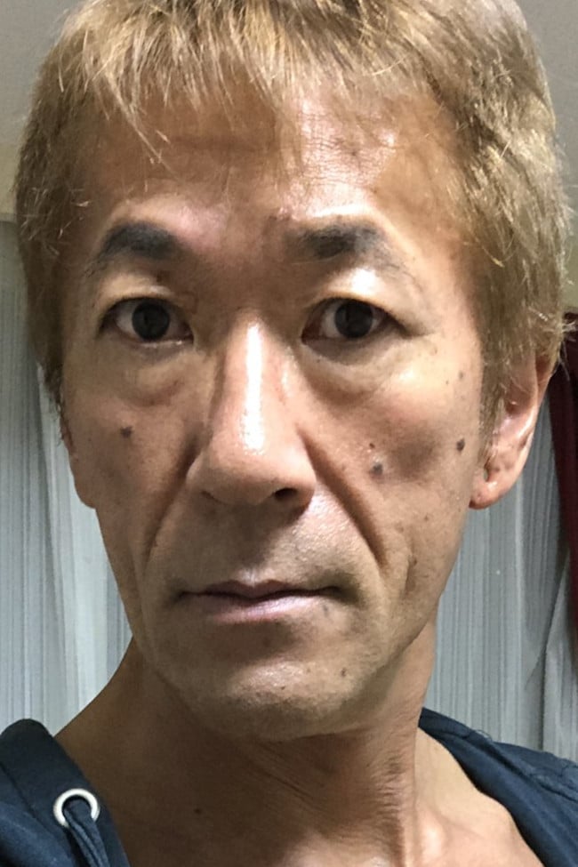 菊淋